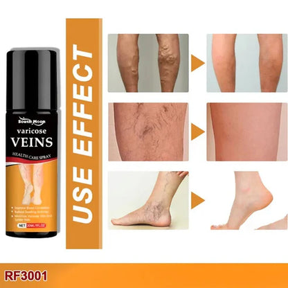 Bees Venom Spray Natural Relief For Varicose Veins & Spider Veins (Pack Of 2)